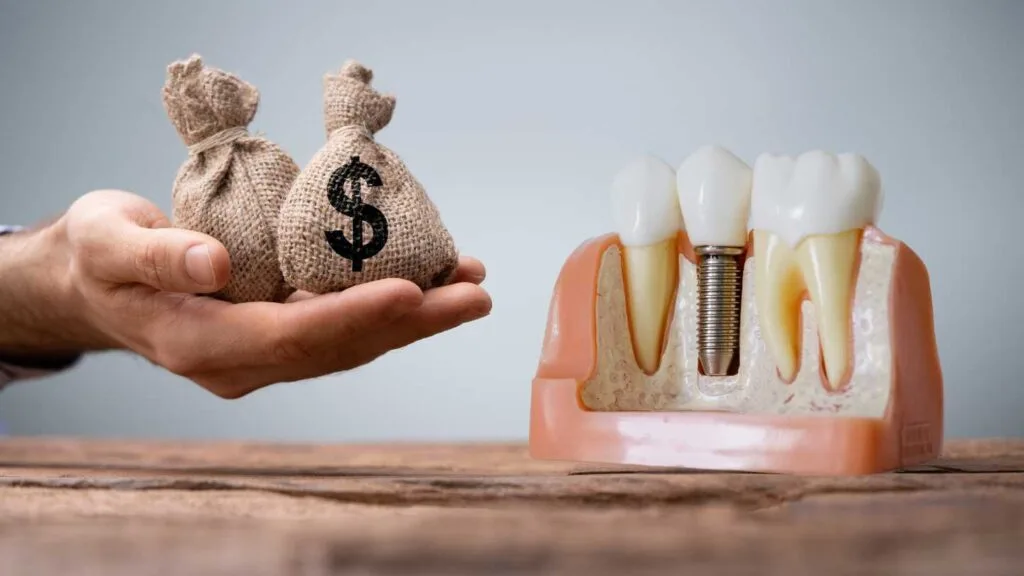 Tipuri de Implanturi Dentare – Ghid Complet 2026